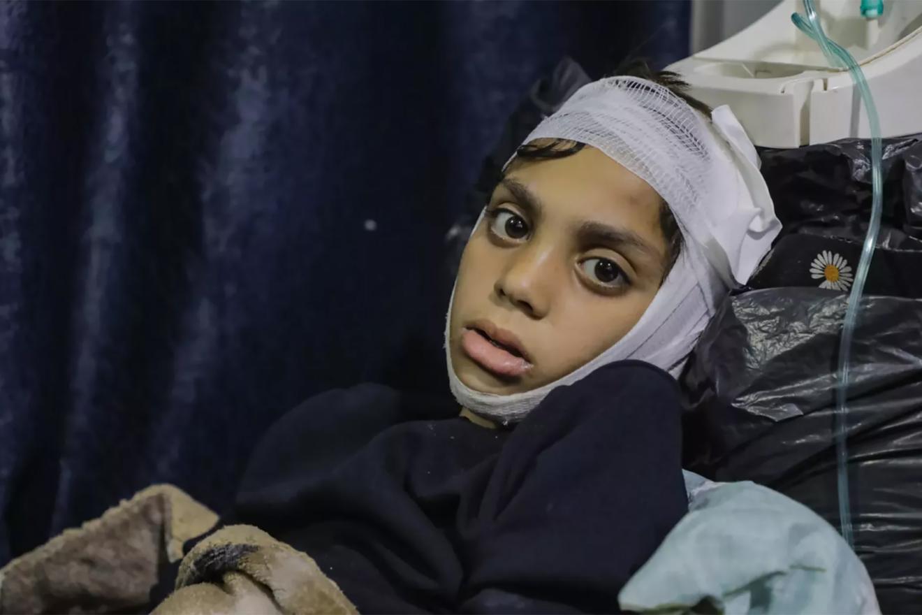 A child with a bandaged head lying down in a medical setting.